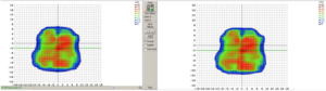Hier sieht man, wie schon bei der IMRT gezeigt, auf dem rechten Bild eine gerechnete, und auf dem linken Bild die dazugehörige, am Bestrahlungsgerät, gemessene Dosisverteilung. (Software SNC Patient V.6.6.0, Fa. Sun Nuclear)